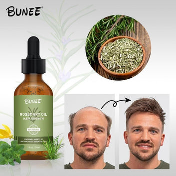Rosemary Hair Growth Serum 30ml